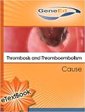 Thrombosis and Thromboembolism: Cause