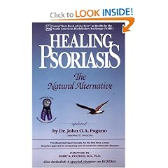 Healing Psoriasis: The Natural Alternative