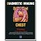 Thoracic Imaging