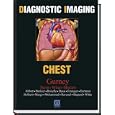 Diagnostic Imaging: Chest by  Jud W. Gurney