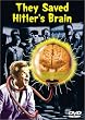 They Saved Hitler's Brain
