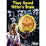 They Saved Hitler's Brain