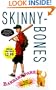 Skinnybones