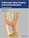 Endoscopic Spine Surgery and Instrumentation