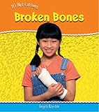 Broken bones