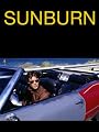 Sunburn