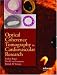 Books : Optical Coherence Tomography in Cardiovascular Research