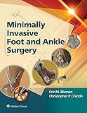 Minimally invasive foot and ankle surgery