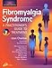 Book Fibromyalgia Syndrome: A Practitioner's Guide to Treatment