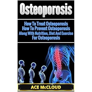 Osteoporosis: How To Treat Osteoporosis- How To Prevent Osteoporosis- Along With Nutrition, Diet And Exercise For Osteoporosis (Reverse or Prevent Bon