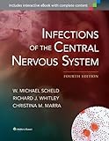 Infections of the central nervous system