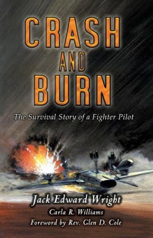 Burns