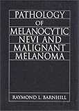 Pathology of Melanocytic Nevi and Malignant Melanoma (Hodder Arnold Publication)