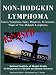 NON-HODGKIN LYMPHOMA: Causes, Symptoms, Signs, Diagnosis, Treatments, Stages of Non-Hodgkin Lymphoma - Revised Edition - Illustrated by S. Smith