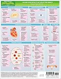 MemoCharts Pharmacology: Major Side Effects of Selected Drugs (Review chart)