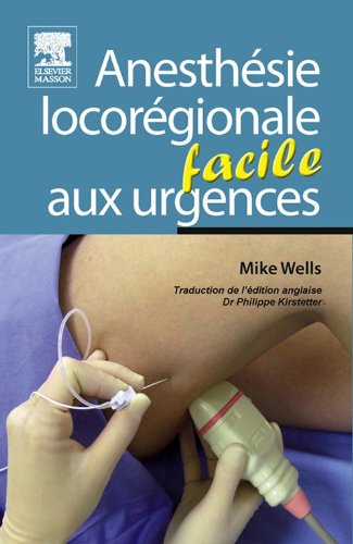 Anesthésie locorégionale facile aux urgences (French Edition)