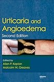 Urticaria and angioedema