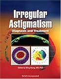 Irregular Astigmatism: Diagnosis and Treatment