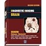 Diagnostic Imaging: Brain: Published by Amirsys®