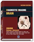 Diagnostic Imaging: Brain: Published by Amirsys