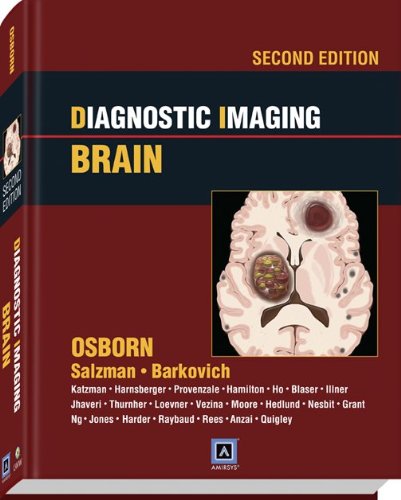 Diagnostic Imaging: Brain: Published by Amirsys