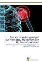 Der Verriegelungsnagel zur Versorgung proximaler Humerusfrakturen: Dreidimensionale Analyse des Nageldesigns am digitalisierten Knochen