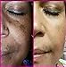 NeriumAD Night Cream New Design