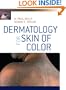 Dermatology for Skin of Color