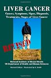 Liver Cancer: Causes, Symptoms, Signs, Diagnosis, Treatments, Stages of Liver Cancer Revised Edition Illustrated by S. Smith 51K0j%2BSb2yL. SL160 Liver Cancer: Causes, Symptoms, Signs, Diagnosis, Treatments, Stages of Liver Cancer Revised Edition Illustrated by S. Smith