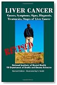 Liver Cancer: Causes, Symptoms, Signs, Diagnosis, Treatments, Stages of Liver Cancer - Revised Edition - Illustrated by S. Smith
