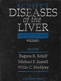 Schiff s Diseases of the Liver (2 Volume Set)