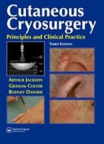Cutaneous Cryosurgery