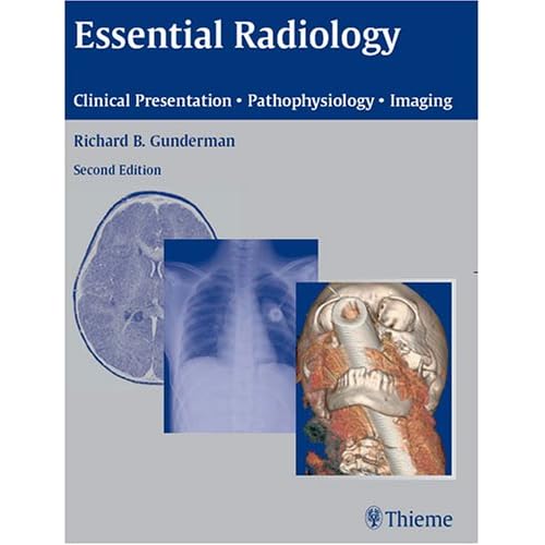 Essential Radiology: Clinical Presentation, Pathophysiology, Imaging