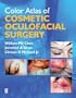 Color Atlas of Cosmetic Oculofacial Surgery, 1e