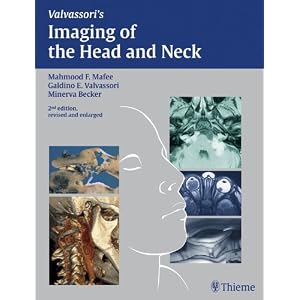 Click here to buy Imaging of the Head and Neck by Mahmood F. Mafee, Galdino E. Valbasson, Minerva Becker, and J. S. Lewin.