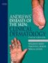 Andrews' Diseases of the Skin: Clinical Dermatology, 10e (James, Andrew's Disease of the Skin)