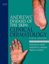 Andrews' Diseases of the Skin: Clinical Dermatology (James, Andrew's Disease of the Skin)