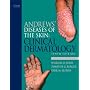 Andrews' Diseases of the Skin: Clinical Dermatology (James, Andrew's Disease of the Skin)