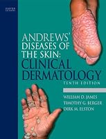 Andrews' Diseases of the Skin: Clinical Dermatology (James, Andrew's Disease of the Skin)