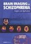 Brain Imaging in Schizophrenia: Insights and Applications