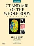 Computed Tomography & Magnetic Resonance Imaging Of The Whole Body E-Book (Computed Tomography and Magnetic Resonance Imaging of the Wh)