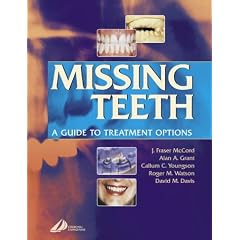 Missing Teeth: A Guide to Treatment Options
