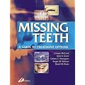 Missing Teeth: A Guide to Treatment Options