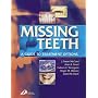 Missing Teeth: A Guide to Treatment Options