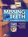 Books : Missing Teeth: A Guide to Treatment Options