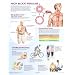 Netter Clinical Charts: High Blood Pressure Chart, 1e (Netter Charts)