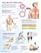 High Blood Pressure Chart (Netter Charts)