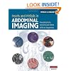 Pearls and Pitfalls in Abdominal Imaging: Pseudotumors, Variants and Other Difficult Diagnoses (Cambridge Medicine)