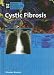 Books : Cystic Fibrosis (Genetic Diseases)