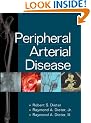 Peripheral Arterial Disease
